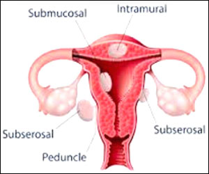 necrosis-of-joint